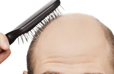 The Truth About Hair Loss and Baldness Cures | Next Avenue The Truth About Hair Loss and Baldness Cures | Next Avenue