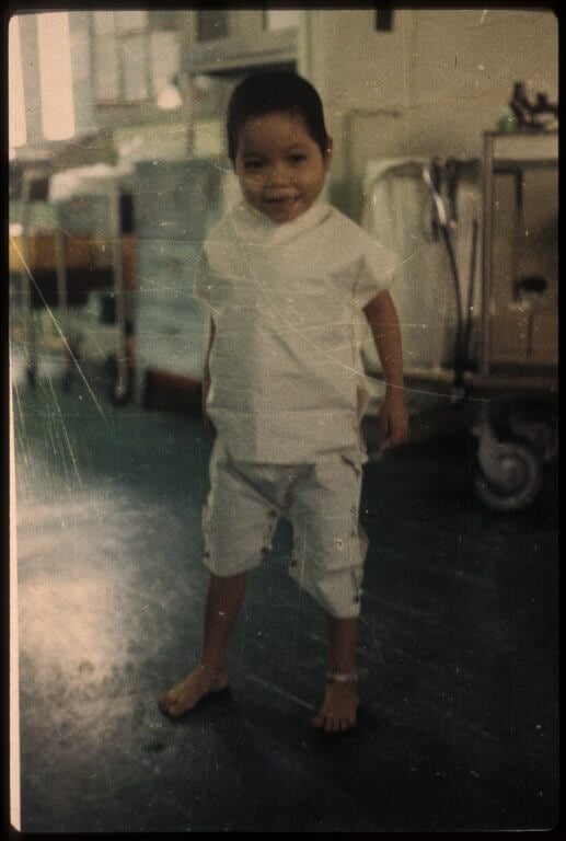 Young Vietnamese child patient standing and smiling in medical facility.