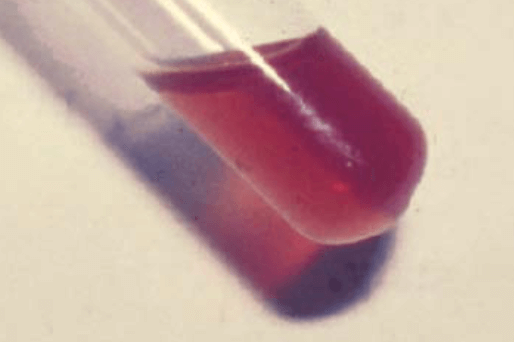 Close up of blood in a test tube